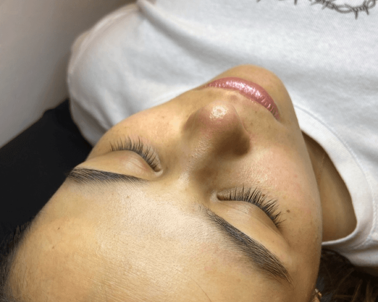 Limpieza facial profunda con extracciones