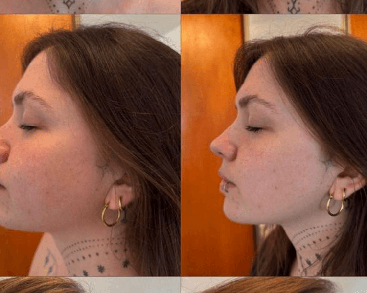 Esculpido de contorno facial