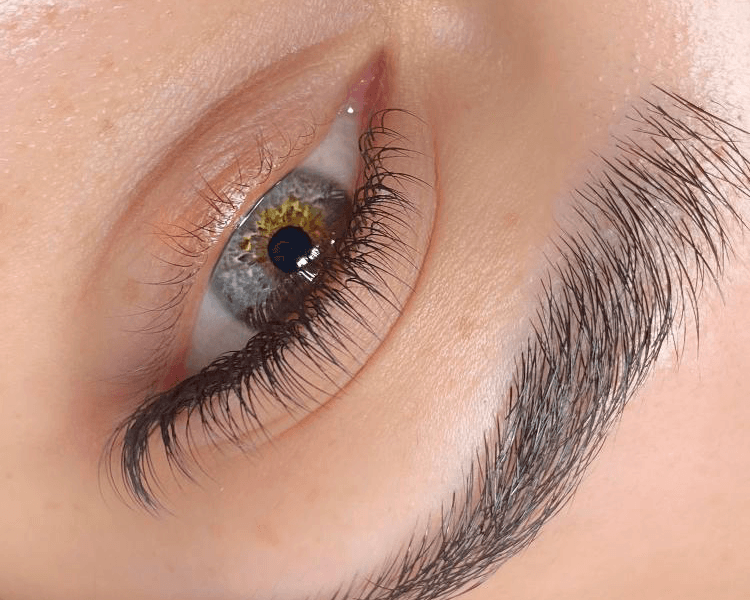 Extensiones Clásicas