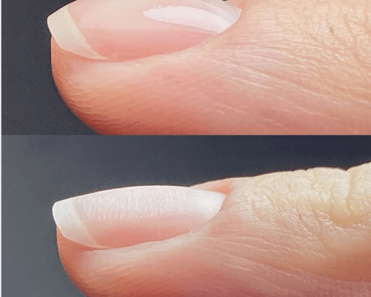 Nivelación base rubber