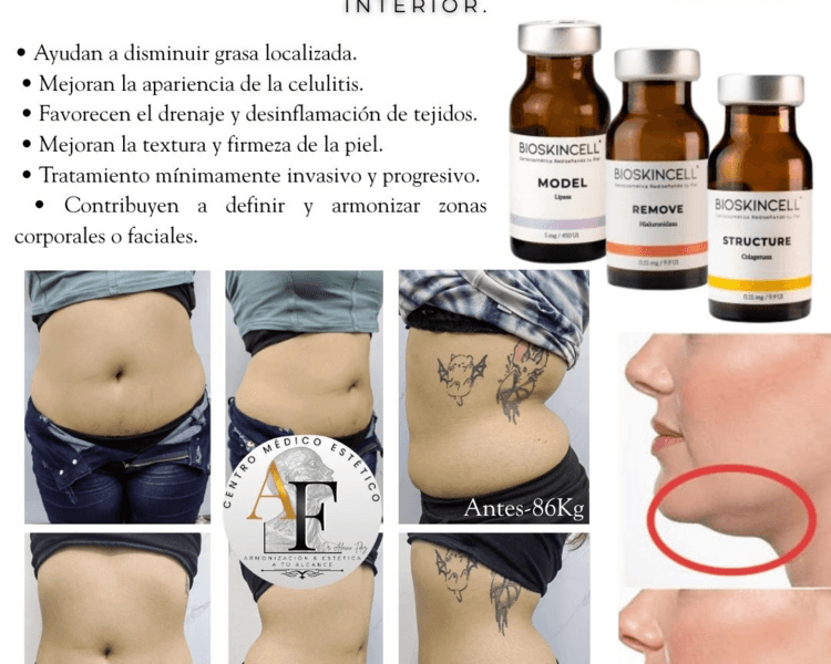Reducción de grasa localizada con Enzimas lipoliticas