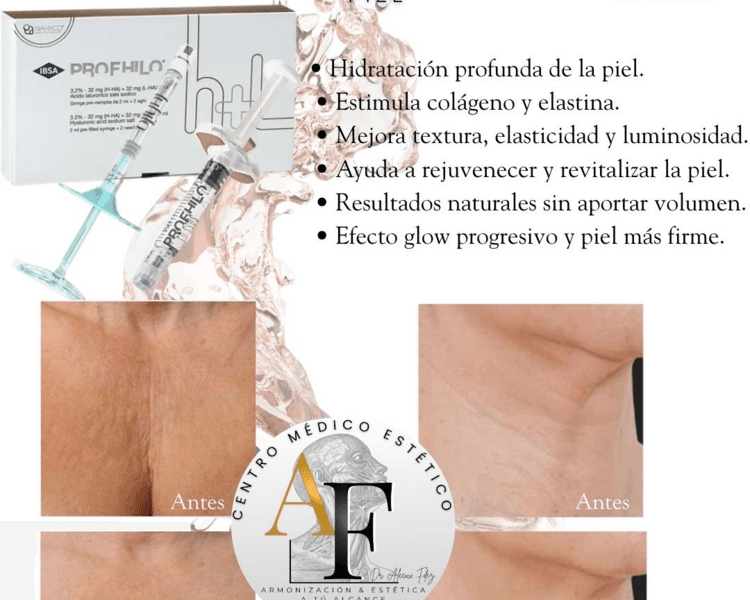 Skin booster PROFHILO 1 jeringa