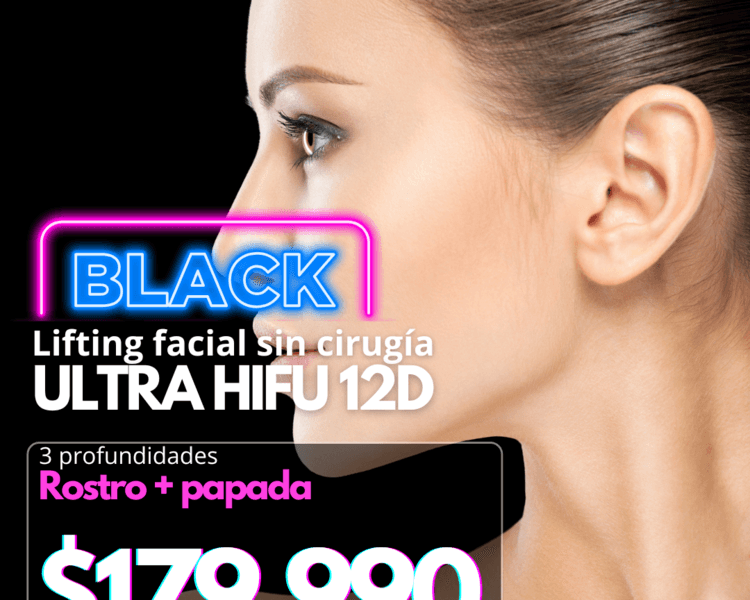 BLACK ULTRA HIFU 12D ROSTRO + PAPADA