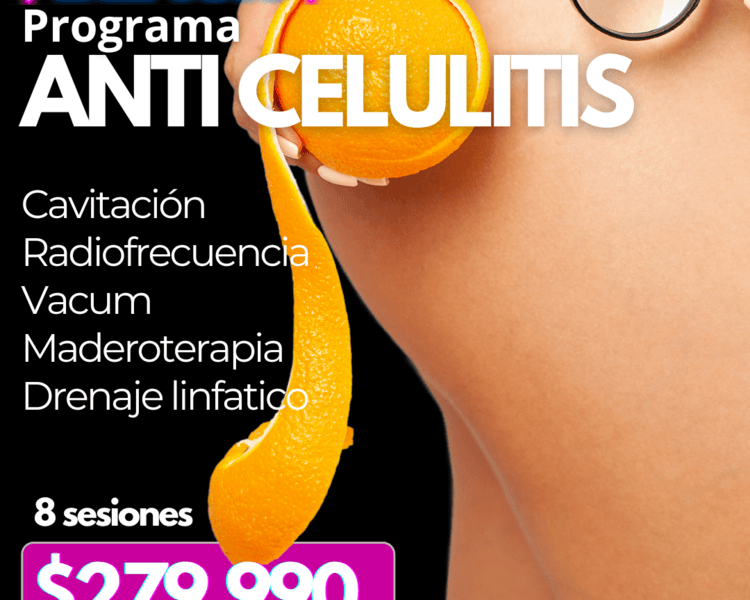 BLACK PROGRAMA ANTICELULITIS