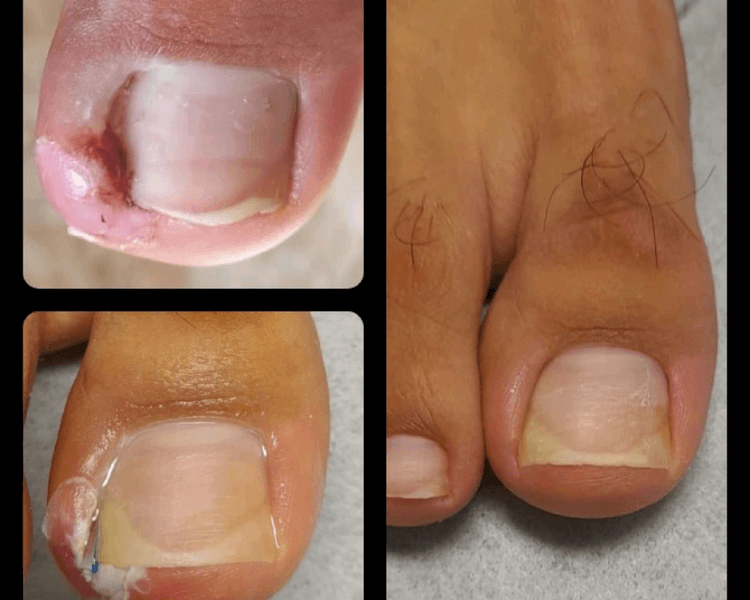 ATENCIÓN PODOLÓGICA ANDREA GUEVARA - señar el turno con el 50% al siguiente alias: Podologa1973