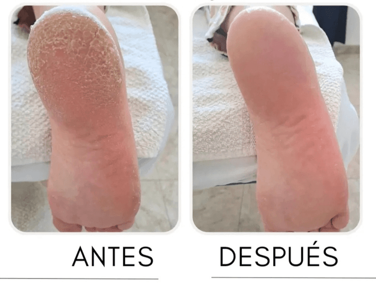 Pedicuría + semipermanente