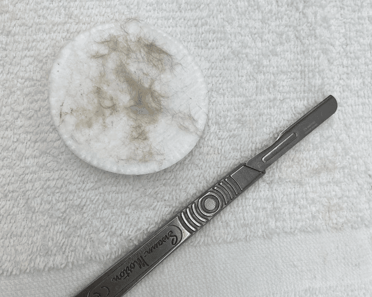 Limpieza + Dermaplaning