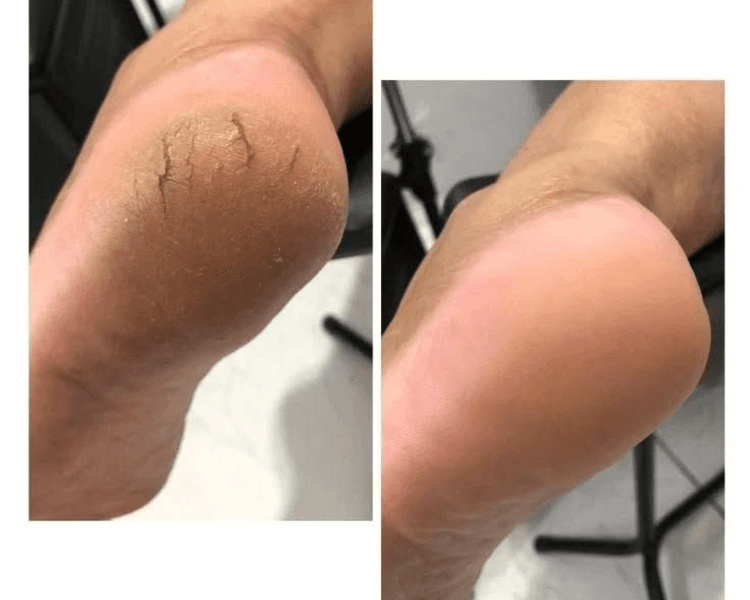 Spa + Semipermanente