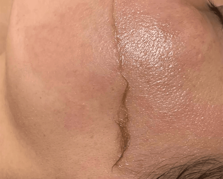 COMBO FULL 60 OFF!! - SOFTGEL + LIFTING + CEJAS FULL + LIMPIEZA FACIAL