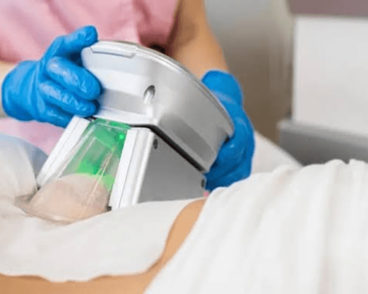 Reductivo criolipolisis pack 6 sesiones