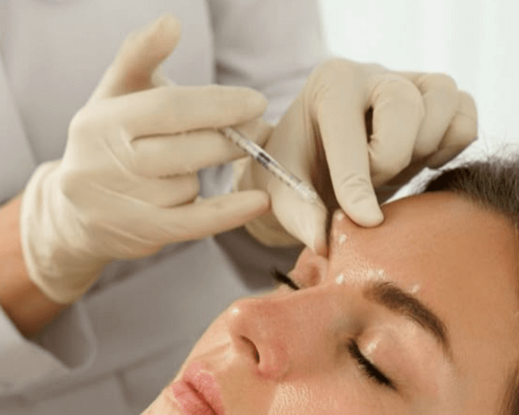 Toxina Botulinica - Tercio Superior