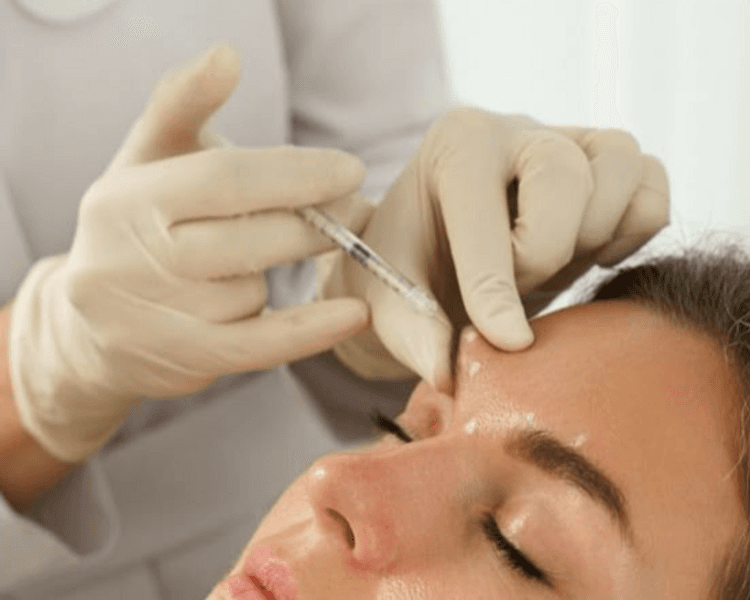 Toxina Botulinica - Patas de Gallo