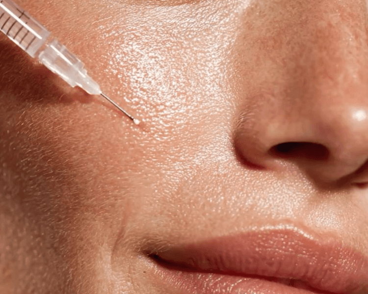 Pack de 4 sesiones - Mesoterapia Facial