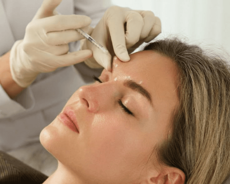 Toxina Botulinica - Entrecejo