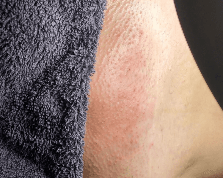 VIKINI PARCIAL,TOTAL Y FULL