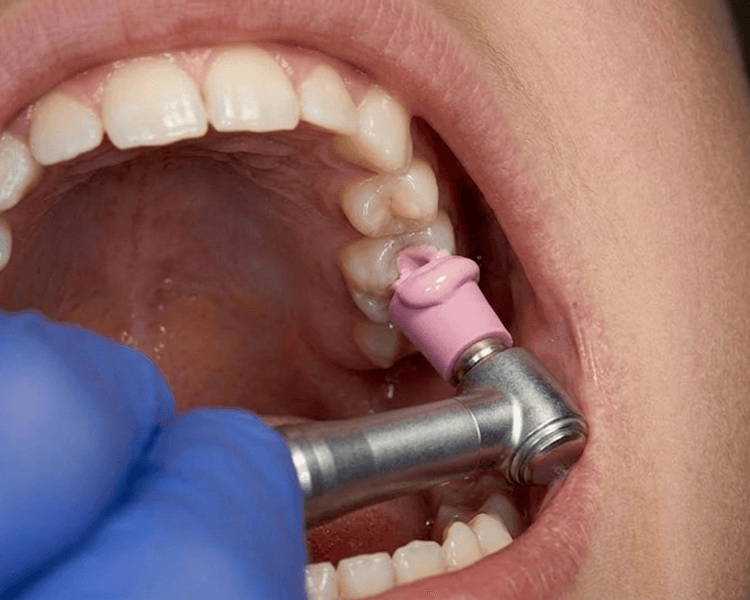 Limpieza adolescente