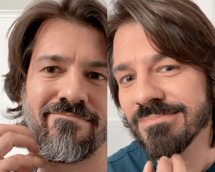 RECUBRIMIENTO DE CANAS.