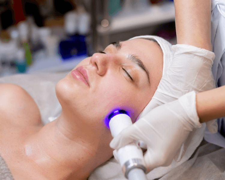 Limpieza facial profunda radiofrecuencia