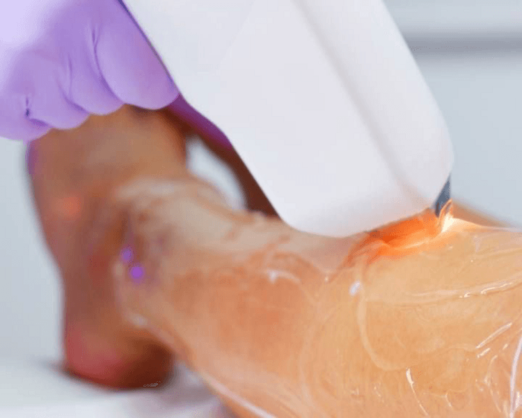 Depilacion de media pierna (sesión)