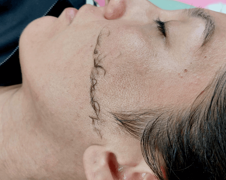 Dermaplaning (incluye limpieza facial)