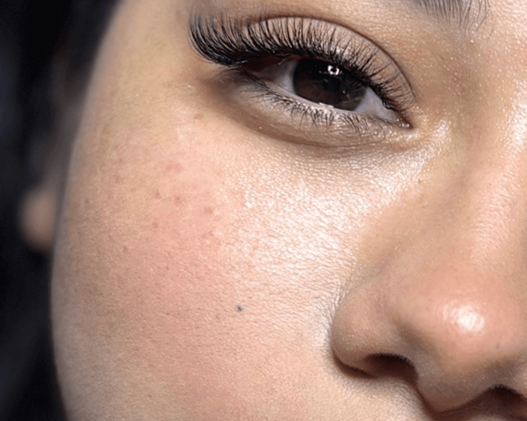 Aplicación nueva Técnica Híbrida