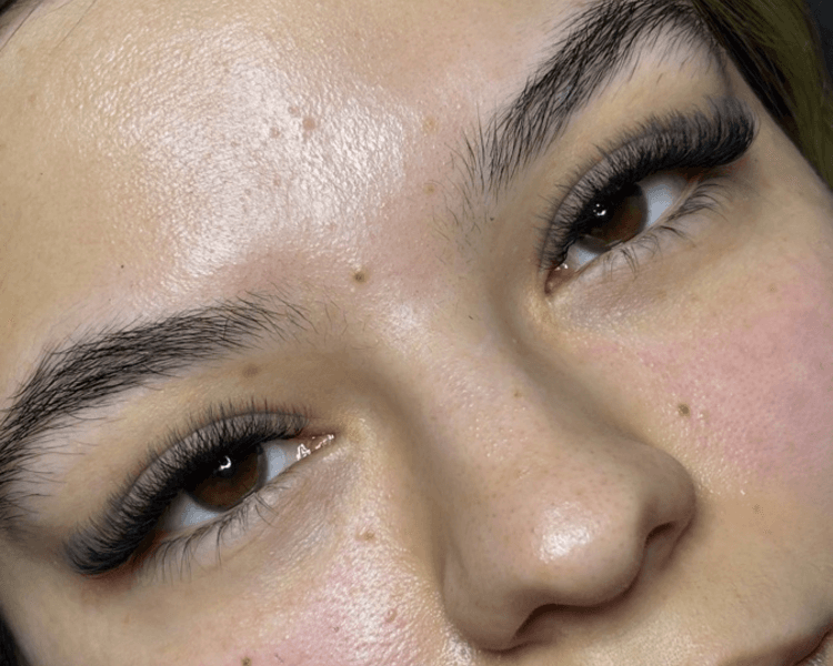 Aplicación Nueva Técnica Volumen