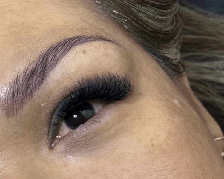 Aplicación Nueva Técnica Mega Volumen