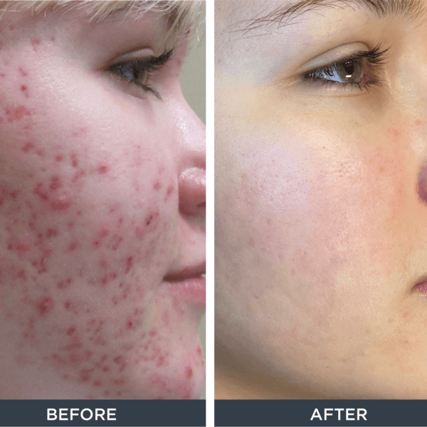 Sesion: Anti texturas y Arrugas!