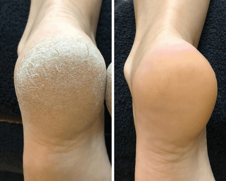 QUIROPEDIA PREVENTIVA