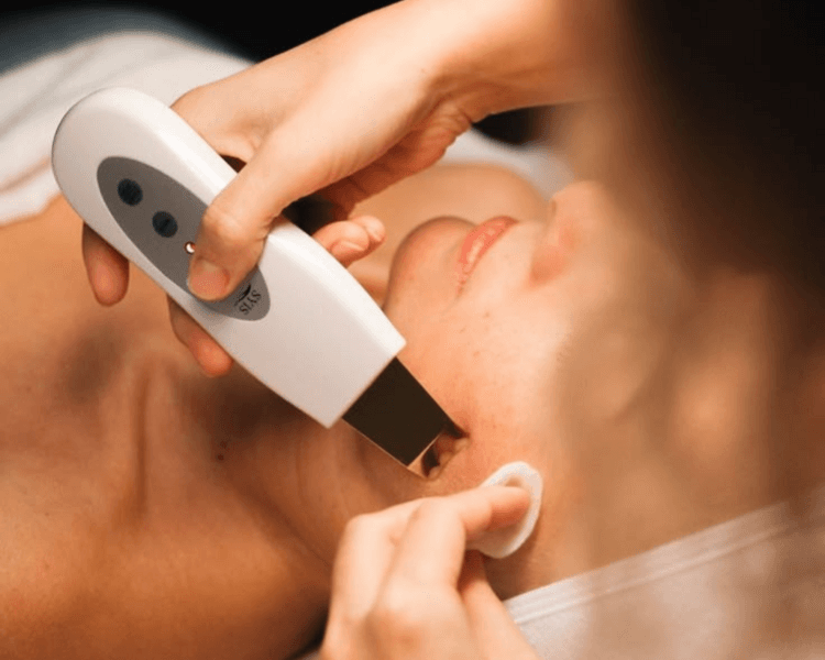 TRATAMIENTOS PARA EL ACNE