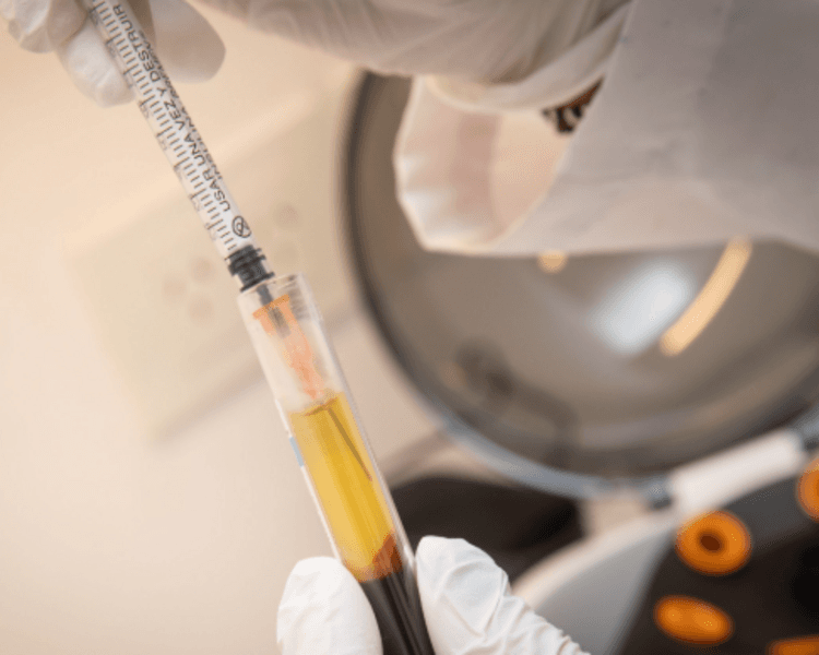 Plasma rico en plaquetas