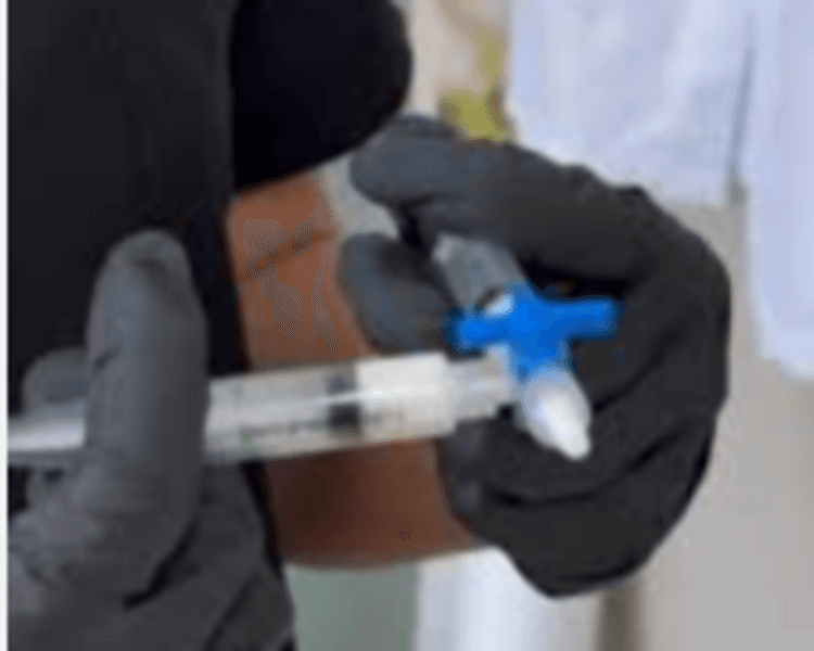 Bioestimulación (Radiesse)