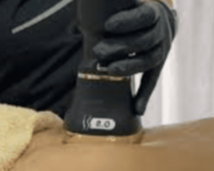 HIFU 25 D + LIPOSONIX