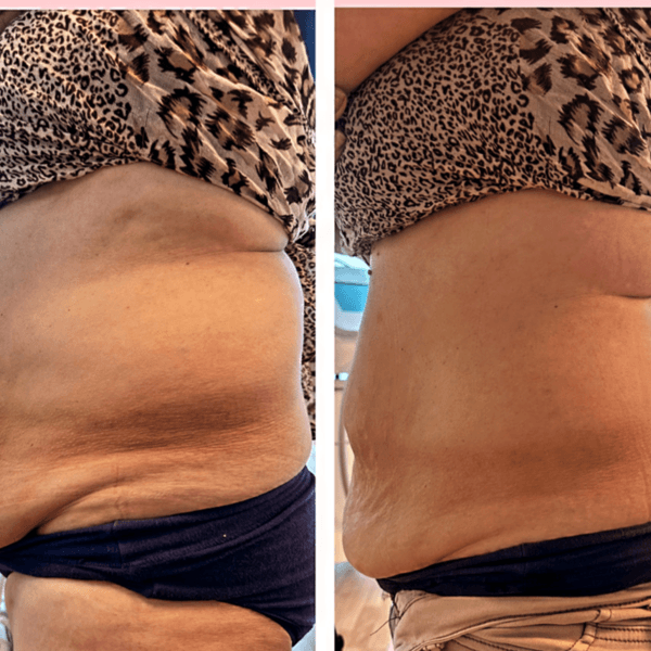 EVALUACIÓN REDUCTIVO