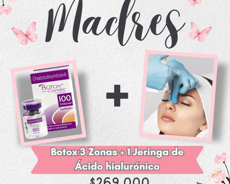 BOTOX+ÁCIDO HIALURÓNICO
