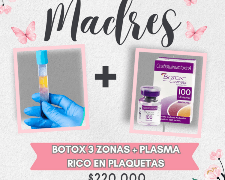 BOTOX 3 ZONAS + PLASMA RICO EN PLAQUETAS