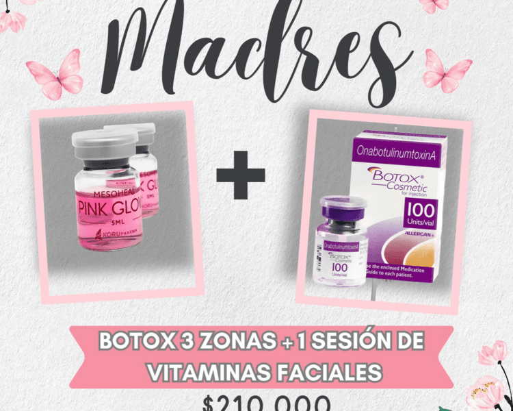 BOTOX 3 ZONAS + 1 SESIÓN DE VITAMINAS FACIALES
