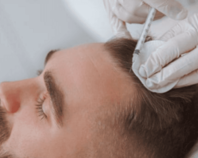 Plasma rico en plaquetas capilar + mesoterapia