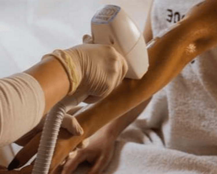 Depilación Láser Promo cuerpo entero mujer