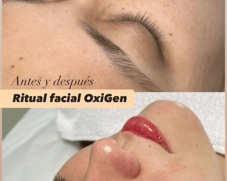 Ritual Oxígen Skin ✨