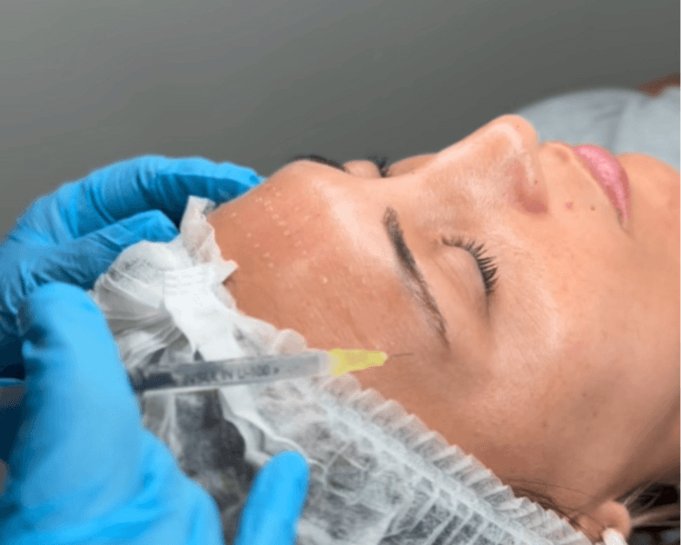 Mesoterapia Facial