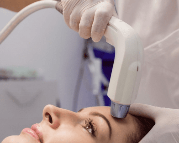 💎 HIFU 13D FACIAL – ROSTRO COMPLETO (1 SESIÓN)