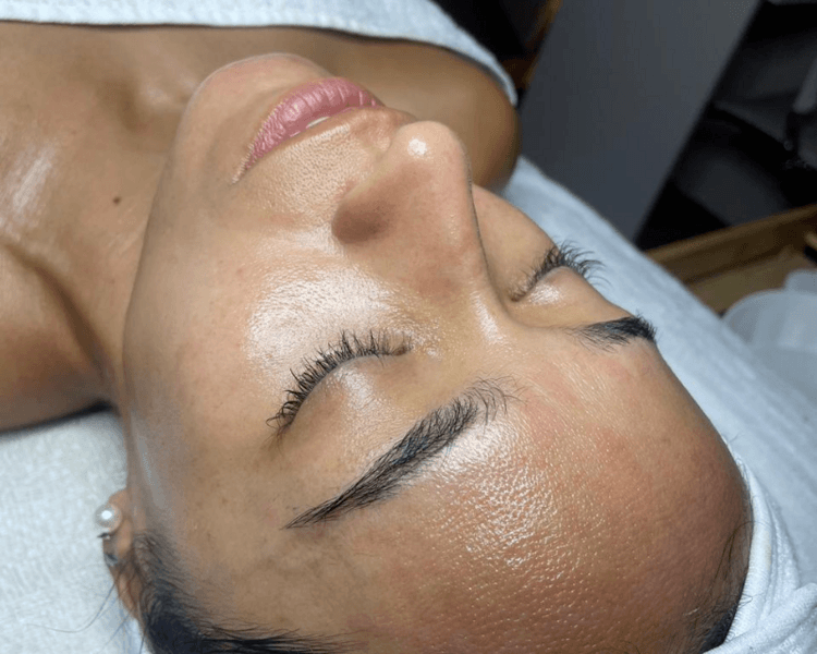 Dermapen