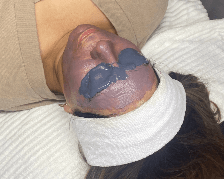 Limpieza facial (especifica)