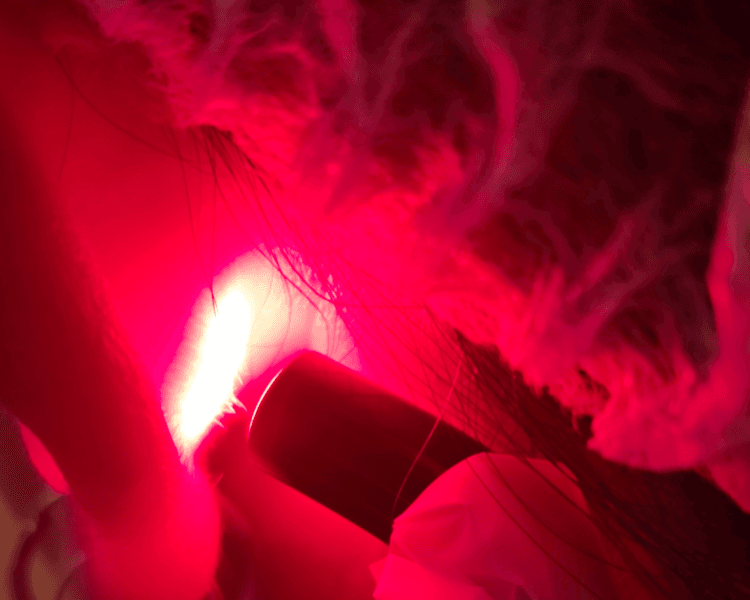 Fotobioestimulación