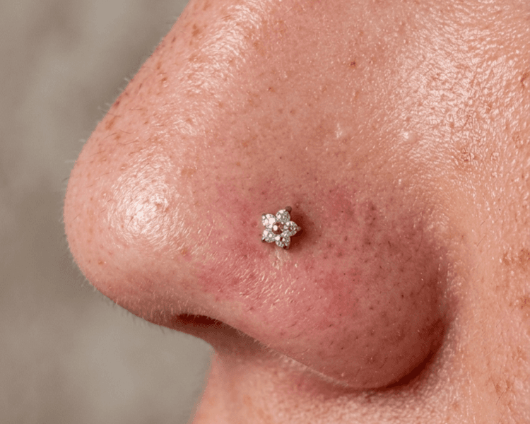 Perforación de Nostril