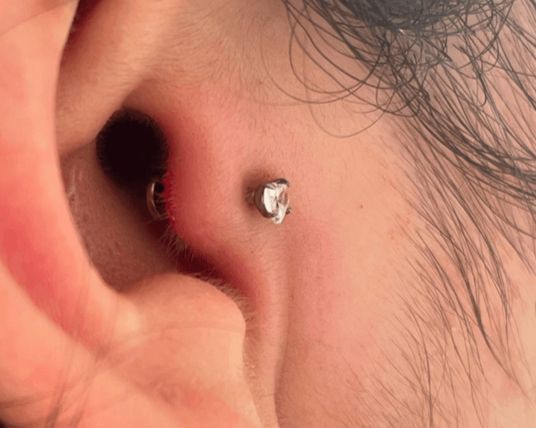 Perforación de Tragus