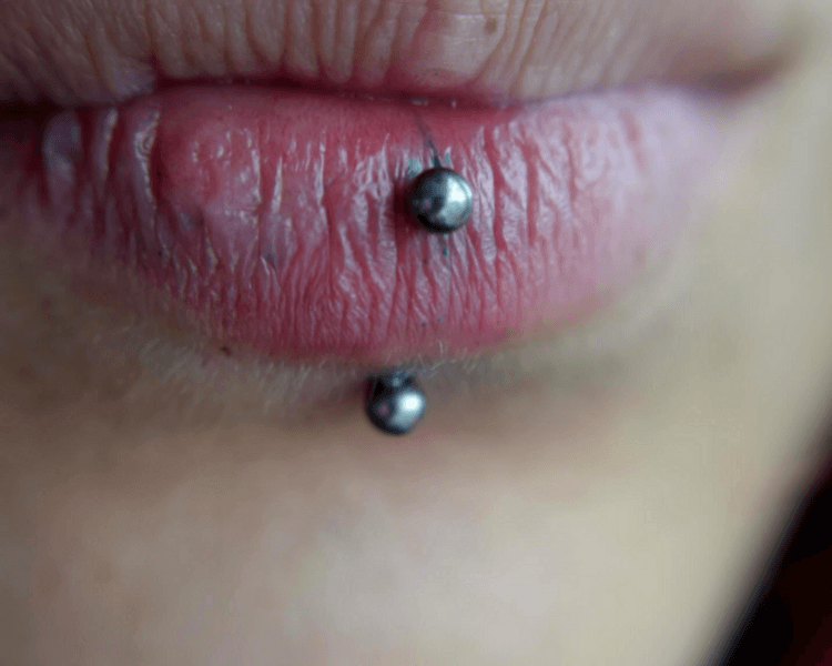 Perforación de VERTICAL LABRET