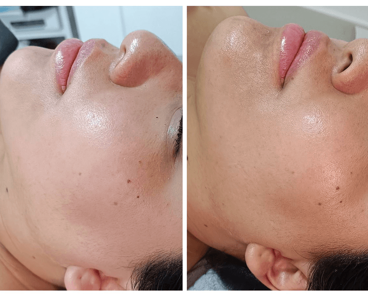 Drenaje linfático 💆🏻♀️✨ por zona