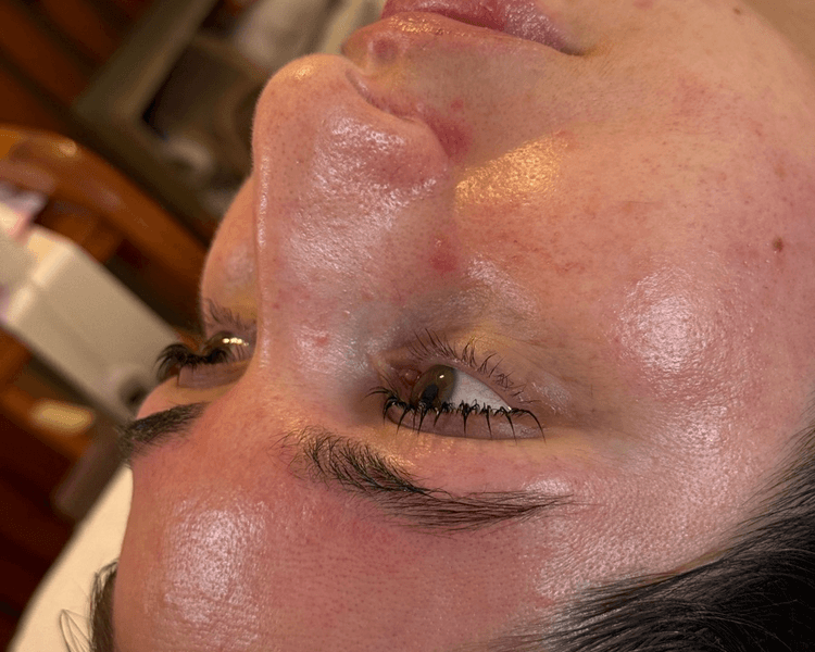 Higiene Facial profunda